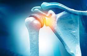 best shoulder replacement surgeon in Delhi